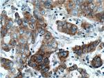 TNK1 Antibody in Immunohistochemistry (Paraffin) (IHC (P))