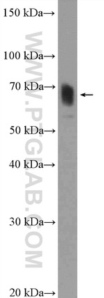 TNK1 Antibody in Western Blot (WB)