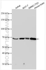B3GNT2 Antibody in Western Blot (WB)