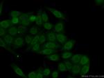 TRIM24 Antibody in Immunocytochemistry (ICC/IF)