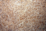 TRIM24 Antibody in Immunohistochemistry (Paraffin) (IHC (P))