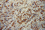 TRIM24 Antibody in Immunohistochemistry (Paraffin) (IHC (P))