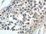 PIWIL2 Antibody in Immunohistochemistry (Paraffin) (IHC (P))