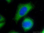 CD39/ENTPD1 Antibody in Immunocytochemistry (ICC/IF)
