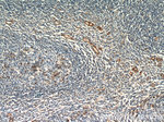 CD39/ENTPD1 Antibody in Immunohistochemistry (Paraffin) (IHC (P))