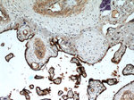 CD39/ENTPD1 Antibody in Immunohistochemistry (Paraffin) (IHC (P))