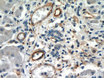 CD39/ENTPD1 Antibody in Immunohistochemistry (Paraffin) (IHC (P))