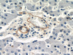CD39/ENTPD1 Antibody in Immunohistochemistry (Paraffin) (IHC (P))