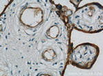 CD39/ENTPD1 Antibody in Immunohistochemistry (Paraffin) (IHC (P))