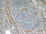 CD39/ENTPD1 Antibody in Immunohistochemistry (Paraffin) (IHC (P))