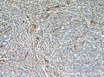 CD39/ENTPD1 Antibody in Immunohistochemistry (Paraffin) (IHC (P))
