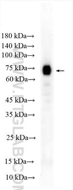 CD39/ENTPD1 Antibody in Western Blot (WB)