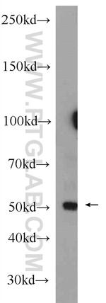 CD39/ENTPD1 Antibody in Western Blot (WB)