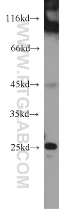 MRAS Antibody in Western Blot (WB)