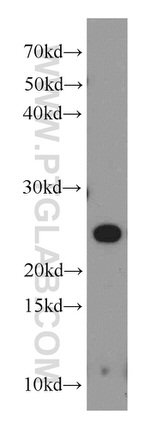 MRAS Antibody in Western Blot (WB)