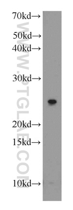 MRAS Antibody in Western Blot (WB)