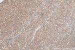 CCL14 Antibody in Immunohistochemistry (Paraffin) (IHC (P))