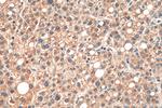 CCL14 Antibody in Immunohistochemistry (Paraffin) (IHC (P))