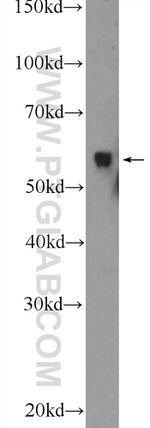 STAU1 Antibody in Western Blot (WB)