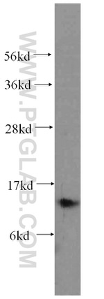 S100A9 Antibody in Western Blot (WB)