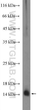 S100A9 Antibody in Western Blot (WB)