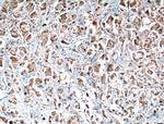 PLCD1 Antibody in Immunohistochemistry (Paraffin) (IHC (P))