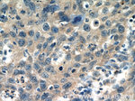 RAP1GAP Antibody in Immunohistochemistry (Paraffin) (IHC (P))