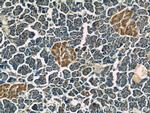 RAP1GAP Antibody in Immunohistochemistry (Paraffin) (IHC (P))