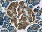 RAP1GAP Antibody in Immunohistochemistry (Paraffin) (IHC (P))