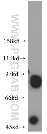 RAP1GAP Antibody in Western Blot (WB)