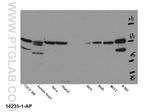 Kv1.2 Antibody in Western Blot (WB)