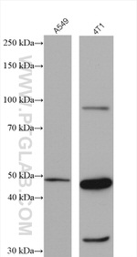 LIV-1/ZIP6 Antibody in Western Blot (WB)