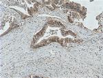 LIV-1/ZIP6 Antibody in Immunohistochemistry (Paraffin) (IHC (P))
