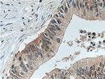 LIV-1/ZIP6 Antibody in Immunohistochemistry (Paraffin) (IHC (P))