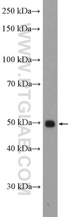 RBMY1A1 Antibody in Western Blot (WB)