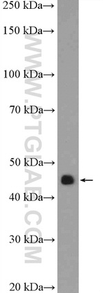 RBMY1A1 Antibody in Western Blot (WB)