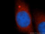 GCLM Antibody in Immunocytochemistry (ICC/IF)