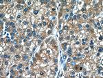 GCLM Antibody in Immunohistochemistry (Paraffin) (IHC (P))