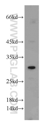 GCLM Antibody in Western Blot (WB)