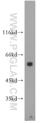 PIAS4 Antibody in Western Blot (WB)