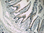 Autotaxin Antibody in Immunohistochemistry (Paraffin) (IHC (P))