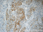 Autotaxin Antibody in Immunohistochemistry (Paraffin) (IHC (P))