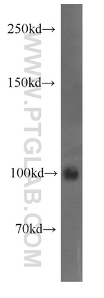 Autotaxin Antibody in Western Blot (WB)