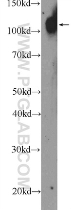 Autotaxin Antibody in Western Blot (WB)