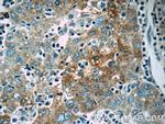 Autotaxin Antibody in Immunohistochemistry (Paraffin) (IHC (P))