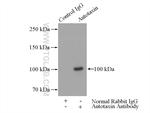 Autotaxin Antibody in Immunoprecipitation (IP)