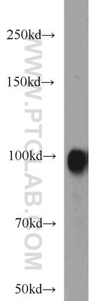 Autotaxin Antibody in Western Blot (WB)