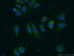 MMP19 Antibody in Immunocytochemistry (ICC/IF)