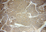 MMP19 Antibody in Immunohistochemistry (Paraffin) (IHC (P))
