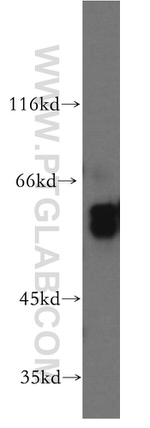 MMP19 Antibody in Western Blot (WB)